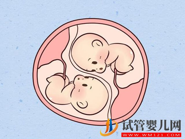 做試管懷雙胞胎能不打胎選破腹產嗎？(圖1)