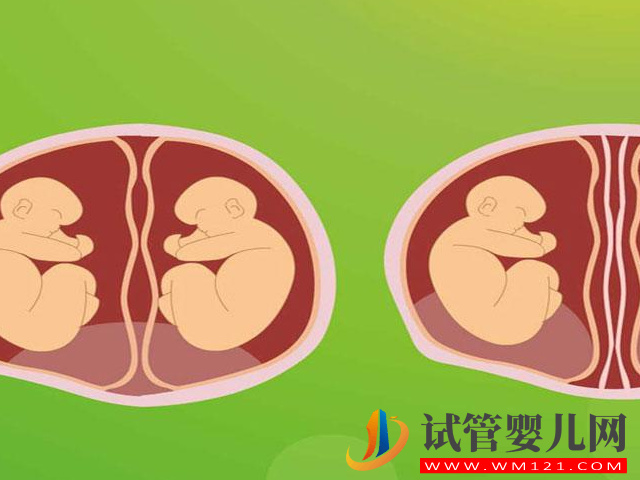 試管嬰兒中的“單卵雙胎”可不是好事，早產(chǎn)、畸形風險高(圖5)