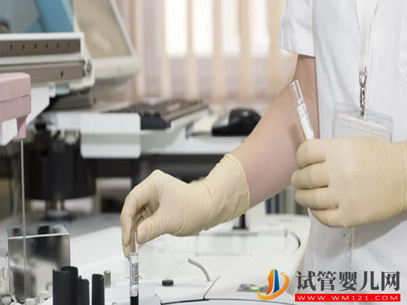 洗精術不適合所有艾滋病患者(圖1)