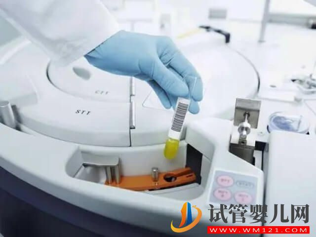 艾滋病毒可以通過洗精技術去除嗎？(圖1)