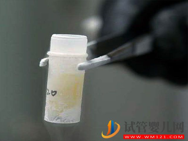 hiv患者可以在國內洗精子嗎？(圖1)