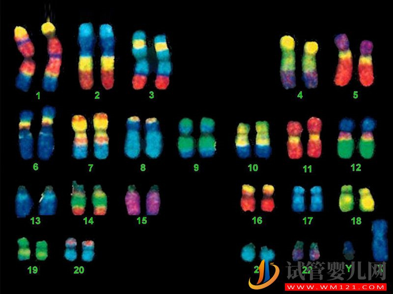 克氏綜合征易導致第三性別，竟都是染色體XXY闖的禍(圖2)