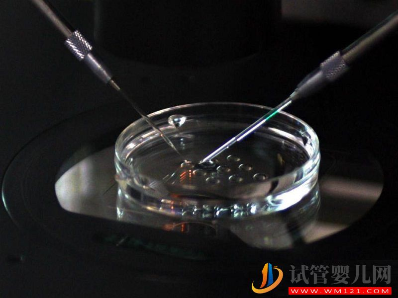 揭秘二代試管全過程，其實就是檢查、進周兩大階段(圖6)