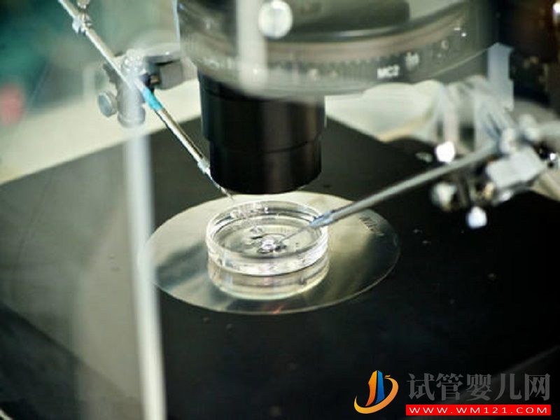 詳解第四代試管的流程，細節(jié)操作你好奇不(圖3)