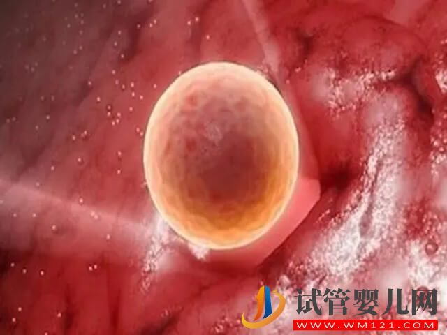  男人弱精還能做試管嬰兒嗎(圖2)