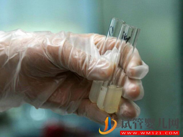 男方精子正常形態比例不大于1%能做試管嗎？(圖1)