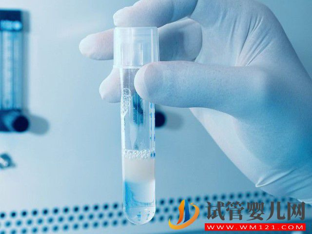 禁欲八天取出來的精子適合做試管嬰兒嗎？(圖1)