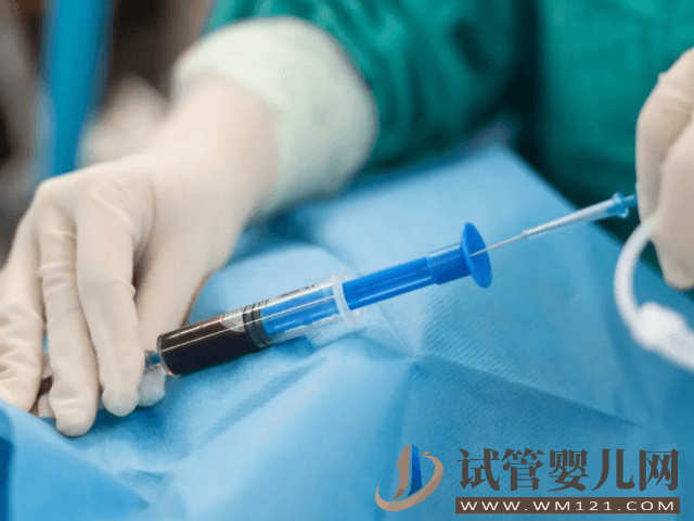 試管pgd技術助孕成功后做羊穿安全嗎？(圖1)