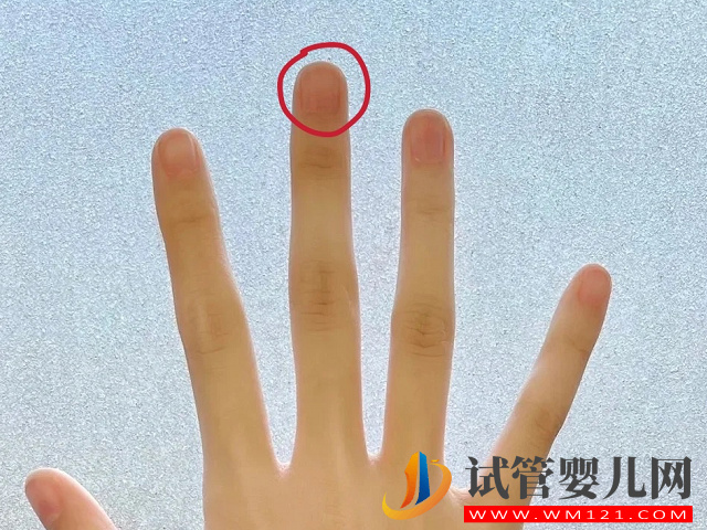 孕期掐中指看男女真的準，在家自測掐這個部位一猜一個準(圖2)