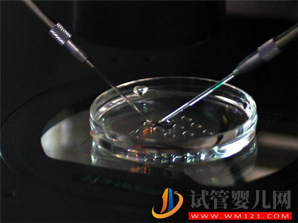 天津983醫院開展第三代試管嬰兒技術了嗎？(圖1)