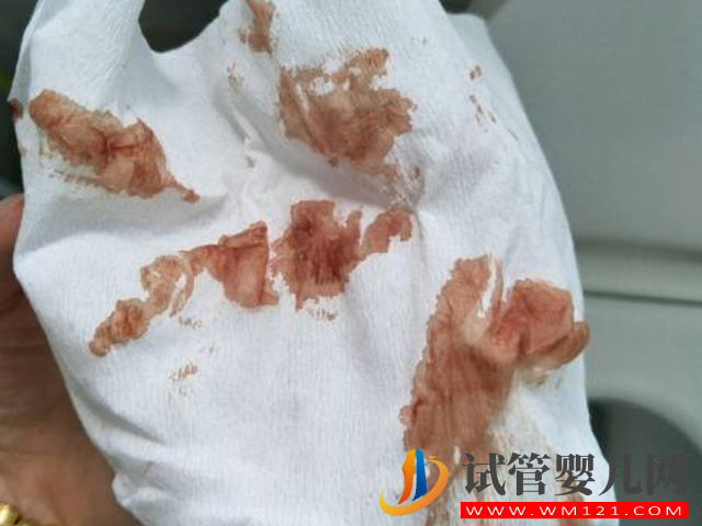 孕早期先兆性流產血呈三種顏色，往往還伴有這些癥狀(圖1)