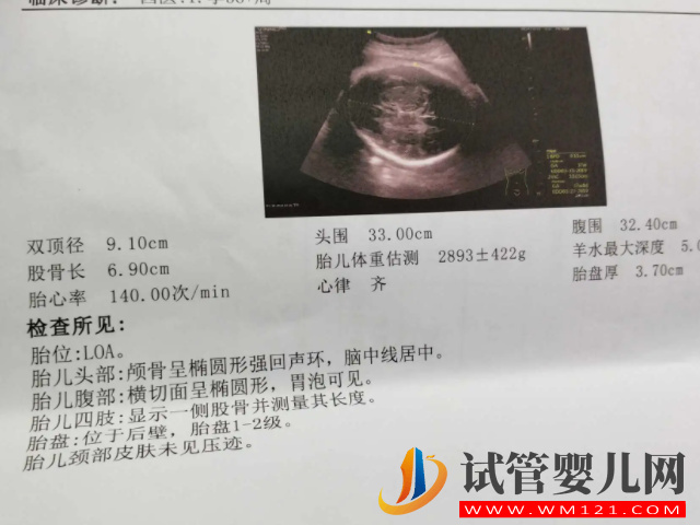 孕周與雙頂徑對(duì)照表分享，簡單一招教你分別是男是女(圖4)