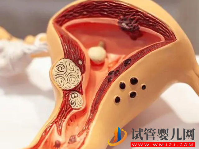 內膜薄必吃的4種促生長中藥方子分享，還您一片肥沃的土壤(圖2)