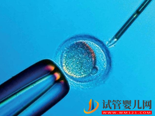 做試管醫生最怕遇到子宮內膜異位患者，其中緣由你必須清楚(圖2)