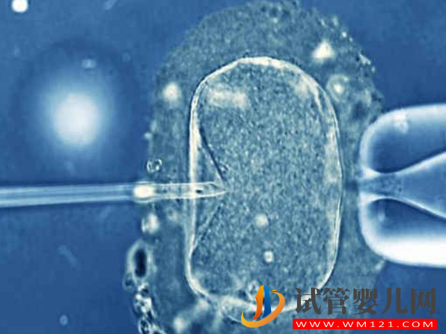 國(guó)內(nèi)去泰國(guó)做三代試管嬰兒攻略，從出國(guó)到回國(guó)全程解析(圖2)