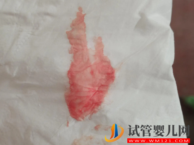 試管移植停藥后出血要警惕，小心是流產、胎停找上門！(圖2)