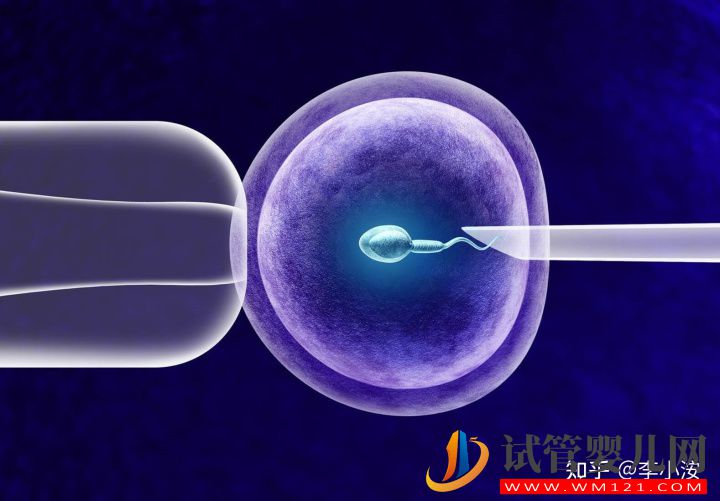 做試管嬰兒前期需要做些什么準備(圖2)