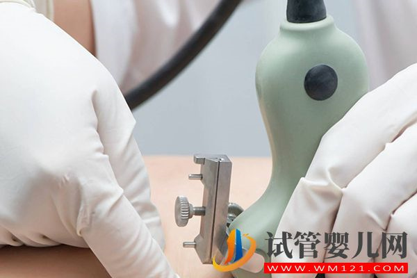 44歲懷孕需要做檢查較多，羊水穿刺和胎心彩超是必做項目(圖3)