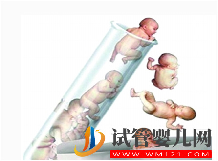 試管嬰兒建檔是怎么回事?(圖2)