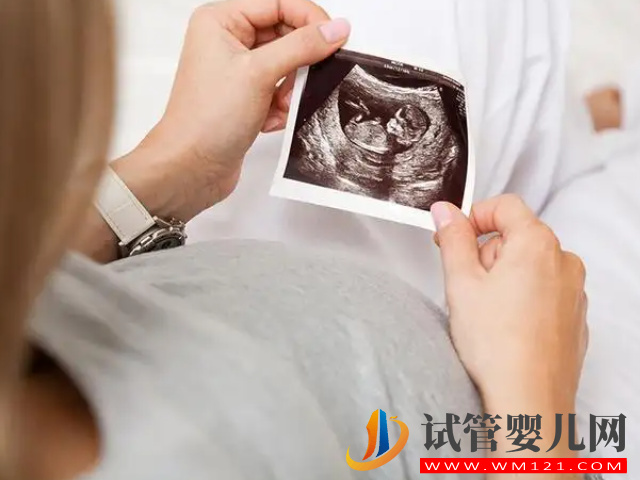 4個(gè)分辨生男女的方法超準(zhǔn)，最早滿8周即可驗(yàn)出性別(圖1)