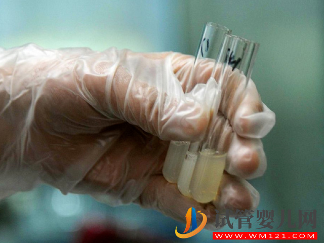 精子檢查報告單正確打開方式，看這7項主要數值就能知全貌(圖3)