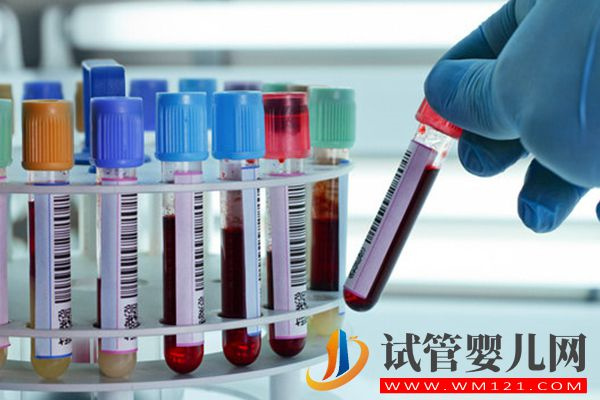 試管促排四項激素值看法詳解：指標正常值范圍可做參考(圖1)