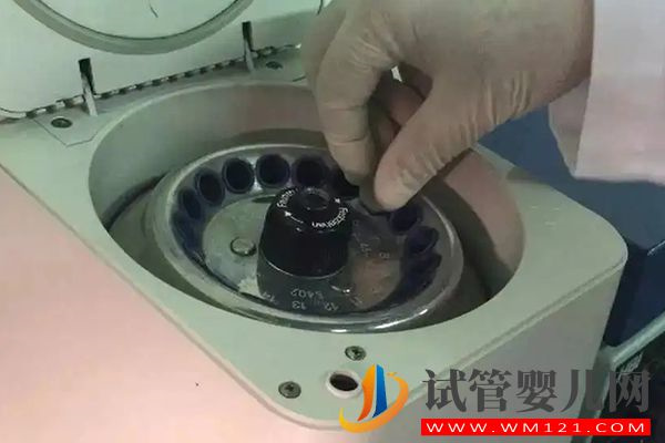 人工受孕精子挑選方法有2種，可直接打到宮頸進行助孕(圖2)