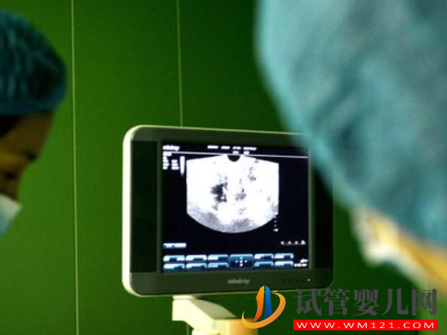 國(guó)內(nèi)同志家庭生育福音，美國(guó)試管對(duì)夫妻性別無要求(圖3)