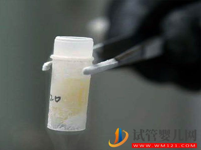 les在國外做試管生孩子需要哪些流程？(圖2)