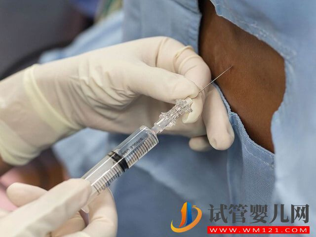 嘉興婦幼做試管取卵移植手術可以選擇全麻嗎？(圖1)