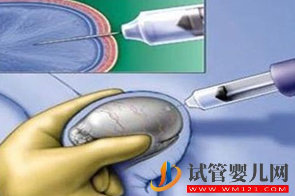 男性睪丸取精試管嬰兒成功率高，做二代助孕不一定要穿刺(圖3)