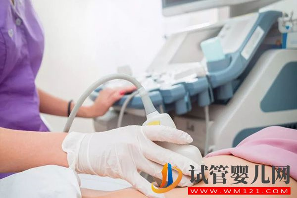 第一次去醫院做試管需做4方面準備，附初次檢查時間(圖3)