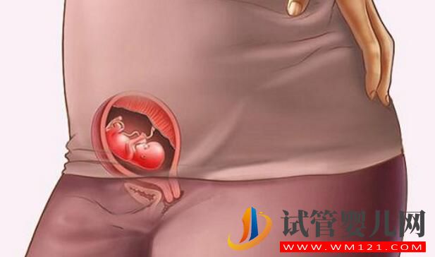 試管嬰兒移植后早期著床有什么反應呢(圖3)