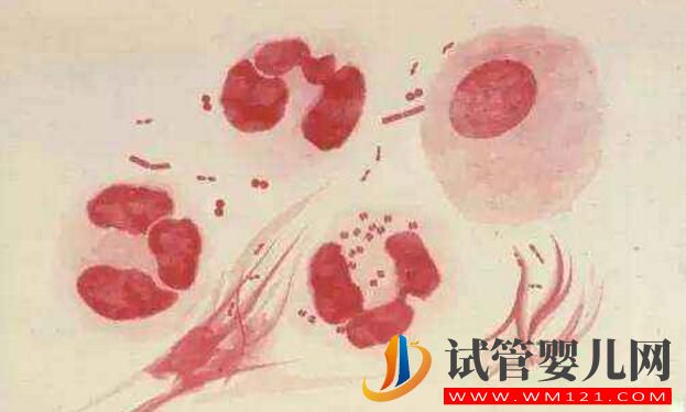 試管嬰兒前期檢查項(xiàng)目報(bào)告你看的懂嗎？看完就會(huì)了(圖5)