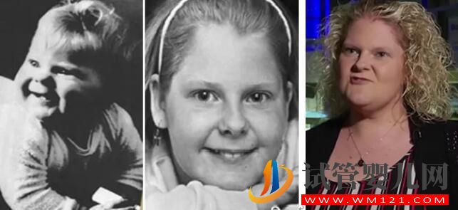 試管嬰兒的七個“較”你知道你知道幾個(圖2)