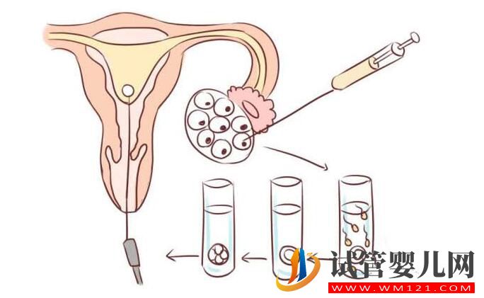 試管嬰兒移植雙胞胎好嗎？去泰國(guó)做成功率怎么樣(圖2)