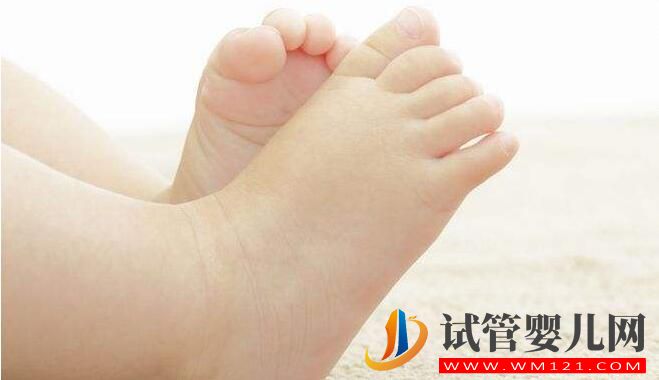 試管嬰兒能做到優生的目的嗎？缺陷兒的產生原因有哪些(圖3)