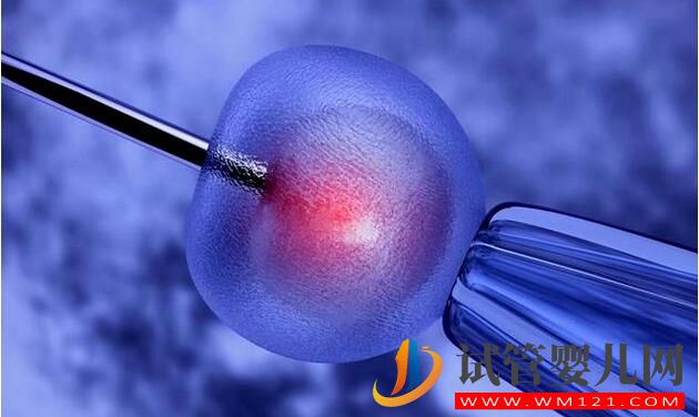 海外做試管嬰兒流程中要花費多少時間呢(圖4)