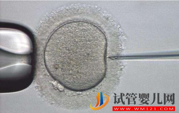 試管嬰兒促排不會(huì)選擇方案 一文加深你對(duì)促排卵方案的了(圖1) 試管嬰兒促排不會(huì)選擇方案 一文加深你對(duì)促排卵方案的了(圖1)