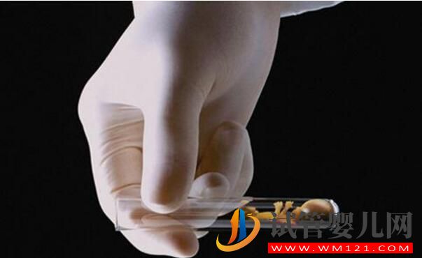 試管嬰兒雙胞胎的幾率有多大，費用一樣嗎？(圖3)