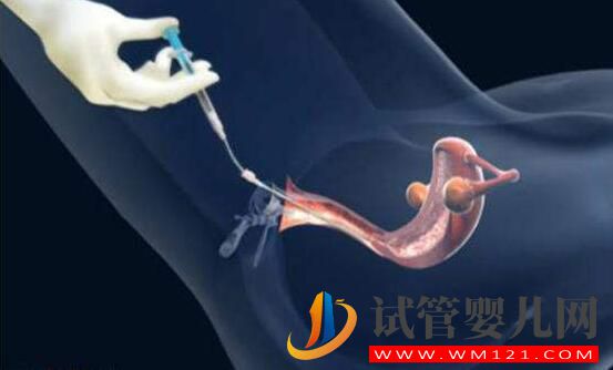 做泰國試管嬰兒的條件 需要哪些證件(圖2)