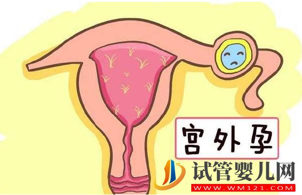 試管嬰兒會發生宮外孕嗎？到底能否避免呢(圖1)
