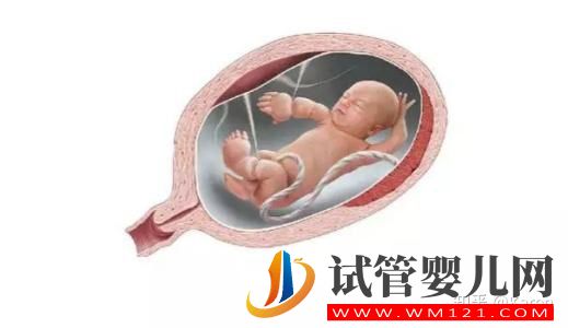 單身不婚族做試管的流程是怎么樣的呢(圖1)