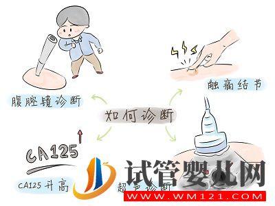 子宮內膜異位癥——痛經的一種常見病因(圖4)