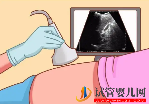 移植尿憋尿誤區一定要看！憋太多不會影響胚胎著床成功(圖1)