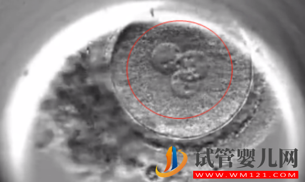 試管2pn胚胎等級大揭秘，來看看和1pn相比哪個好(圖2)