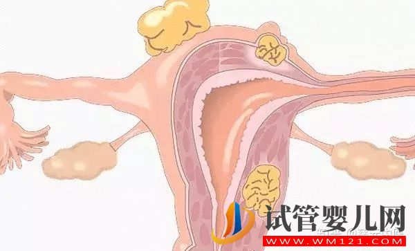 閉經(jīng)是由什么原因引起的呢？閉經(jīng)又和絕經(jīng)有什么區(qū)別？(圖6)