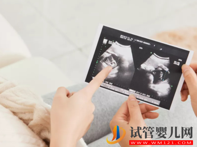 四維b超單子上有男女的暗示，有這兩點基本是男孩了(圖2)