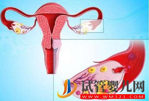 卵巢早衰怎樣調理做試管？(圖1)