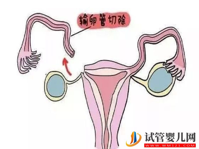 輸卵管切除的滎陽備孕女性看過來，這些醫院可助你一臂之力(圖1)